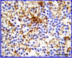 MAB360 | Anti-Glial Fibrillary Acidic Protein Antibody, clone GA5